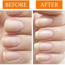 Load image into Gallery viewer, Before and after picture of fingernails CND Rescue Rxx Pen
