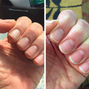 Before and after pictures CND Solar Oil
